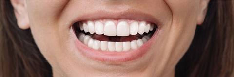Diamond Invisalign Provider 2025 AP Dental Boston Florida After Result