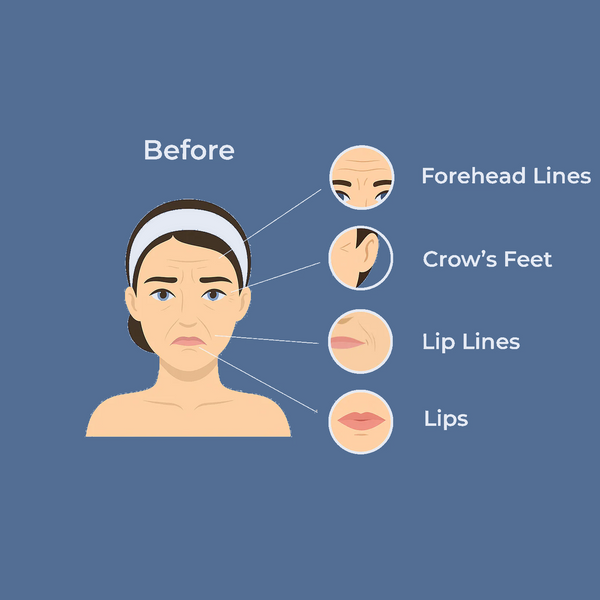 Before treatment